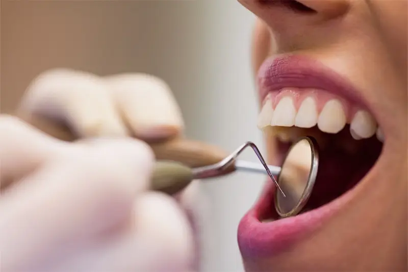 dental implants medellin for foreigners
