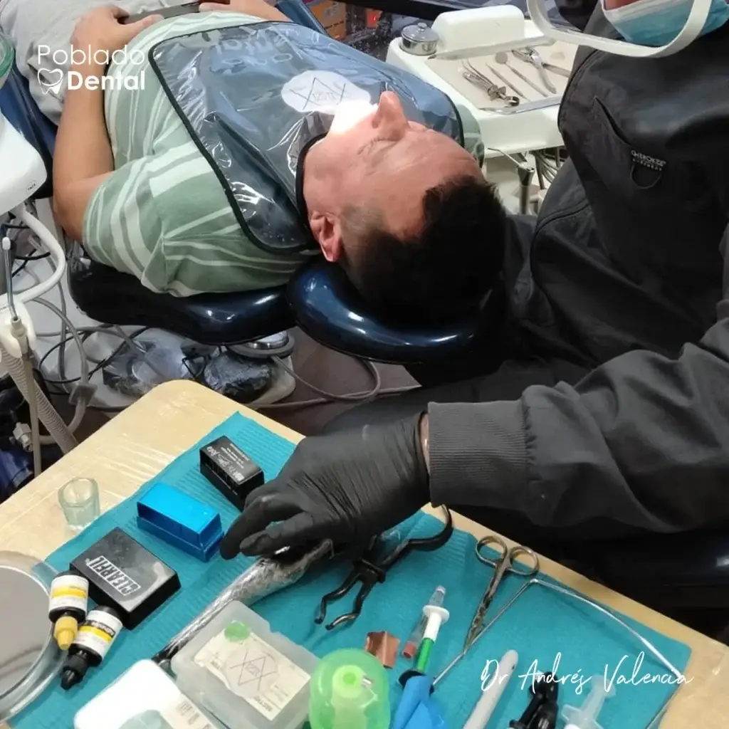 Dr. Andrés Valencia preparando una calza en resina para caries en Poblado Dental, Medellín